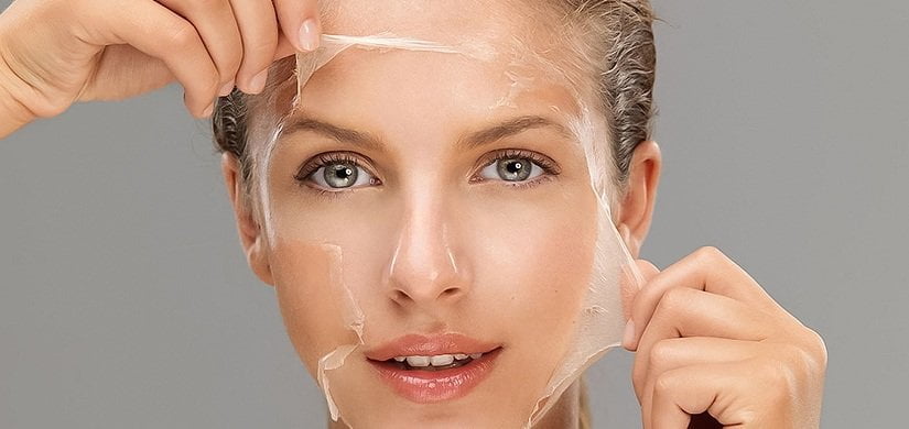 chemical-peeling-skin-resurfacing
